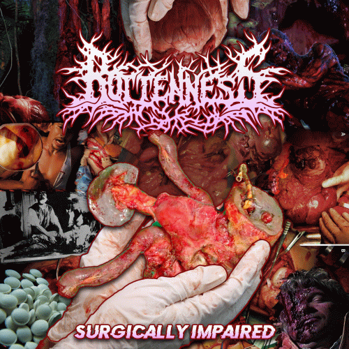 Rottenness : Surgically Impaired